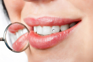 Dental jewelry as a present idea